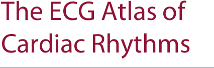 book of egc atlas of cardiac rhythms