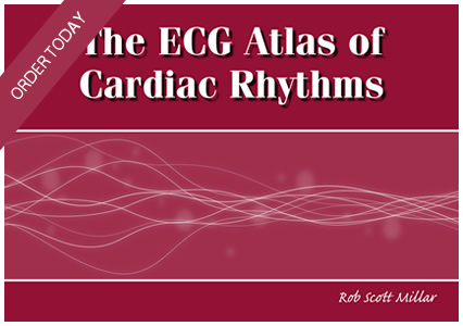 ecg learning book